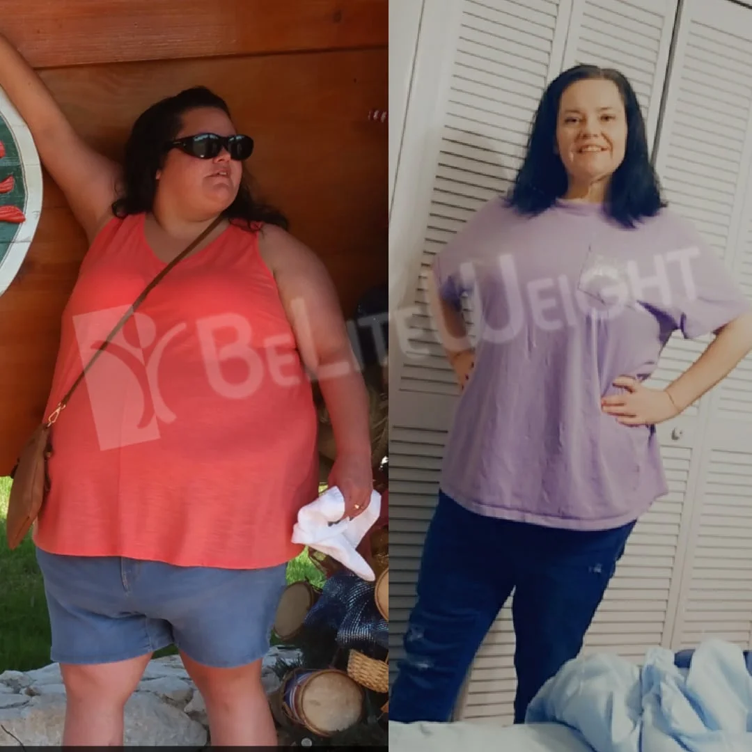 Alicia P - 2 Year Update*